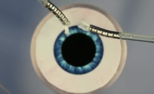 Tentacled Robot Performs Microsurgery on Eyes
