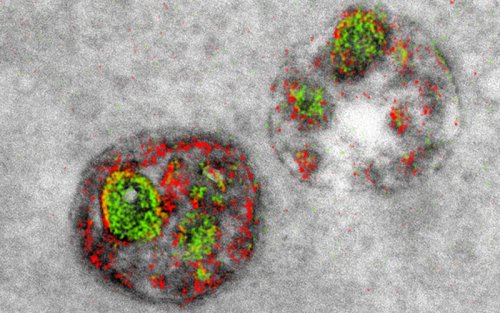 Elektron mikroskop vasitəsilə ilk rəngli təsvir əldə olunub, Elm və Təhsil Nazirliyi, Elm ve Tehsil Nazirliyi, Azərbaycan Respublikası Elm və Təhsil Nazirliyi, Azerbaycan Respublikasi Elm ve Tehsil Nazirliyi, Elm və Ali Təhsil üzrə Dövlət Agentliyi, Elm və Ali Təhsil, AMEA, Azərbaycan Milli Elmlər Akademiyası, Elmler Akademiyasi, İnformasiya Texnologiyaları İnstitutu, İnformasiya Texnologiyaları, AMEA ITI, AMEA İTİ, İTİ, ITI, ikt.az, ict.az, ict, ikt, www.ict.az, www.ikt.az, Rasim Aliguliyev, Rasim Əliquliyev, RM Əliquliyev, Əliquliyev Rasim, Academician Rasim Aliguliyev
