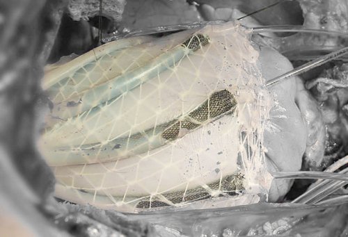 Yumşaq implantat-robot hazırlanıb, Elm və Təhsil Nazirliyi, Elm ve Tehsil Nazirliyi, Azərbaycan Respublikası Elm və Təhsil Nazirliyi, Azerbaycan Respublikasi Elm ve Tehsil Nazirliyi, Elm və Ali Təhsil üzrə Dövlət Agentliyi, Elm və Ali Təhsil, AMEA, Azərbaycan Milli Elmlər Akademiyası, Elmler Akademiyasi, İnformasiya Texnologiyaları İnstitutu, İnformasiya Texnologiyaları, AMEA ITI, AMEA İTİ, İTİ, ITI, ikt.az, ict.az, ict, ikt, www.ict.az, www.ikt.az, Rasim Aliguliyev, Rasim Əliquliyev, RM Əliquliyev, Əliquliyev Rasim, Academician Rasim Aliguliyev