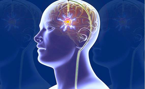 Beyinin fəaliyyətini yaxşılaşdıran qurğu hazırlanıb, Elm və Təhsil Nazirliyi, Elm ve Tehsil Nazirliyi, Azərbaycan Respublikası Elm və Təhsil Nazirliyi, Azerbaycan Respublikasi Elm ve Tehsil Nazirliyi, Elm və Ali Təhsil üzrə Dövlət Agentliyi, Elm və Ali Təhsil, AMEA, Azərbaycan Milli Elmlər Akademiyası, Elmler Akademiyasi, İnformasiya Texnologiyaları İnstitutu, İnformasiya Texnologiyaları, AMEA ITI, AMEA İTİ, İTİ, ITI, ikt.az, ict.az, ict, ikt, www.ict.az, www.ikt.az, Rasim Aliguliyev, Rasim Əliquliyev, RM Əliquliyev, Əliquliyev Rasim, Academician Rasim Aliguliyev