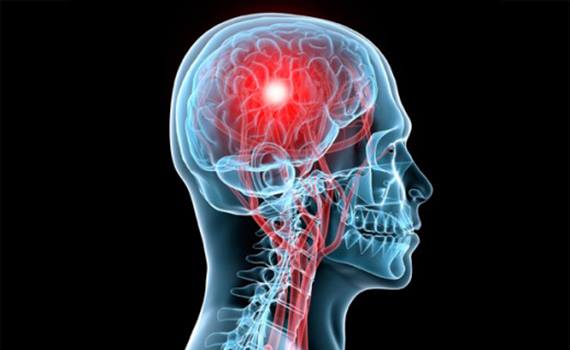 В DARPA протестировали нейроимплант - усилитель памяти