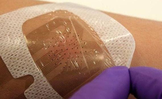 "Smart" bandage tracks wound healing with sensors