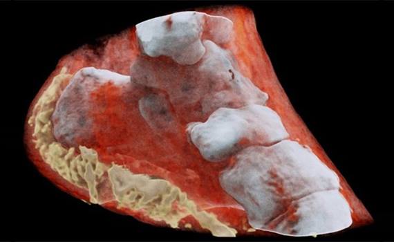 İlk üçölçülü rəngli rentgen şəkli çəkilib, Elm və Təhsil Nazirliyi, Elm ve Tehsil Nazirliyi, Azərbaycan Respublikası Elm və Təhsil Nazirliyi, Azerbaycan Respublikasi Elm ve Tehsil Nazirliyi, Elm və Ali Təhsil üzrə Dövlət Agentliyi, Elm və Ali Təhsil, AMEA, Azərbaycan Milli Elmlər Akademiyası, Elmler Akademiyasi, İnformasiya Texnologiyaları İnstitutu, İnformasiya Texnologiyaları, AMEA ITI, AMEA İTİ, İTİ, ITI, ikt.az, ict.az, ict, ikt, www.ict.az, www.ikt.az, Rasim Aliguliyev, Rasim Əliquliyev, RM Əliquliyev, Əliquliyev Rasim, Academician Rasim Aliguliyev