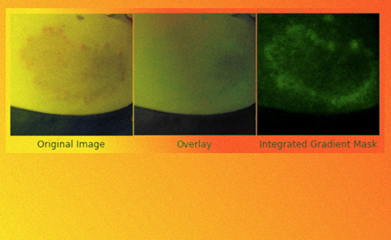 Yeni alqoritm dəri xəstəliklərinə diaqnoz qoyacaq, Elm və Təhsil Nazirliyi, Elm ve Tehsil Nazirliyi, Azərbaycan Respublikası Elm və Təhsil Nazirliyi, Azerbaycan Respublikasi Elm ve Tehsil Nazirliyi, Elm və Ali Təhsil üzrə Dövlət Agentliyi, Elm və Ali Təhsil, AMEA, Azərbaycan Milli Elmlər Akademiyası, Elmler Akademiyasi, İnformasiya Texnologiyaları İnstitutu, İnformasiya Texnologiyaları, AMEA ITI, AMEA İTİ, İTİ, ITI, ikt.az, ict.az, ict, ikt, www.ict.az, www.ikt.az, Rasim Aliguliyev, Rasim Əliquliyev, RM Əliquliyev, Əliquliyev Rasim, Academician Rasim Aliguliyev