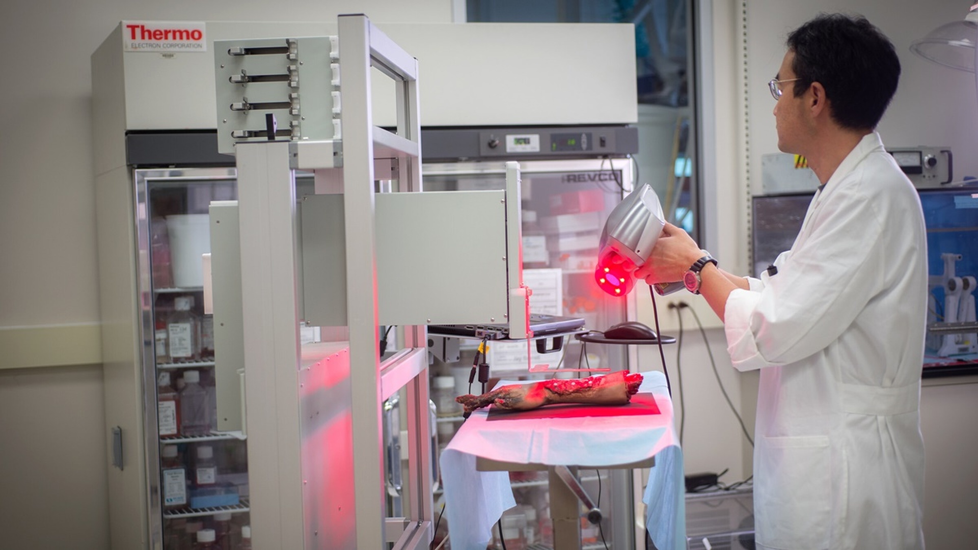 Mobil 3D-bioprinter dərini birbaşa yaranın üzərinə çap edəcək, Elm və Təhsil Nazirliyi, Elm ve Tehsil Nazirliyi, Azərbaycan Respublikası Elm və Təhsil Nazirliyi, Azerbaycan Respublikasi Elm ve Tehsil Nazirliyi, Elm və Ali Təhsil üzrə Dövlət Agentliyi, Elm və Ali Təhsil, AMEA, Azərbaycan Milli Elmlər Akademiyası, Elmler Akademiyasi, İnformasiya Texnologiyaları İnstitutu, İnformasiya Texnologiyaları, AMEA ITI, AMEA İTİ, İTİ, ITI, ikt.az, ict.az, ict, ikt, www.ict.az, www.ikt.az, Rasim Aliguliyev, Rasim Əliquliyev, RM Əliquliyev, Əliquliyev Rasim, Academician Rasim Aliguliyev