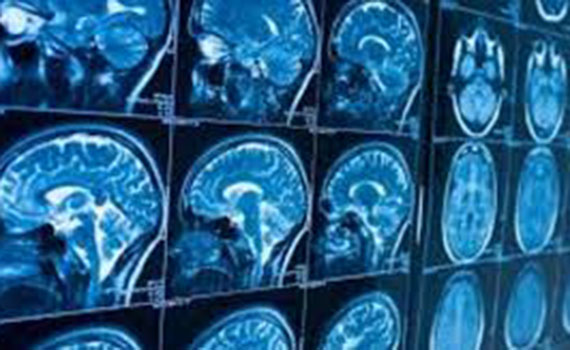 Yeni viruslar ölümcül xəstələrin tədqiqat nəticələrini dəyişdirir, Elm və Təhsil Nazirliyi, Elm ve Tehsil Nazirliyi, Azərbaycan Respublikası Elm və Təhsil Nazirliyi, Azerbaycan Respublikasi Elm ve Tehsil Nazirliyi, Elm və Ali Təhsil üzrə Dövlət Agentliyi, Elm və Ali Təhsil, AMEA, Azərbaycan Milli Elmlər Akademiyası, Elmler Akademiyasi, İnformasiya Texnologiyaları İnstitutu, İnformasiya Texnologiyaları, AMEA ITI, AMEA İTİ, İTİ, ITI, ikt.az, ict.az, ict, ikt, www.ict.az, www.ikt.az, Rasim Aliguliyev, Rasim Əliquliyev, RM Əliquliyev, Əliquliyev Rasim, Academician Rasim Aliguliyev