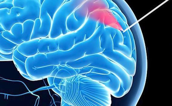 Beyin biopsiyası üçün kameralı “ağıllı” iynə hazırlanıb, Elm və Təhsil Nazirliyi, Elm ve Tehsil Nazirliyi, Azərbaycan Respublikası Elm və Təhsil Nazirliyi, Azerbaycan Respublikasi Elm ve Tehsil Nazirliyi, Elm və Ali Təhsil üzrə Dövlət Agentliyi, Elm və Ali Təhsil, AMEA, Azərbaycan Milli Elmlər Akademiyası, Elmler Akademiyasi, İnformasiya Texnologiyaları İnstitutu, İnformasiya Texnologiyaları, AMEA ITI, AMEA İTİ, İTİ, ITI, ikt.az, ict.az, ict, ikt, www.ict.az, www.ikt.az, Rasim Aliguliyev, Rasim Əliquliyev, RM Əliquliyev, Əliquliyev Rasim, Academician Rasim Aliguliyev