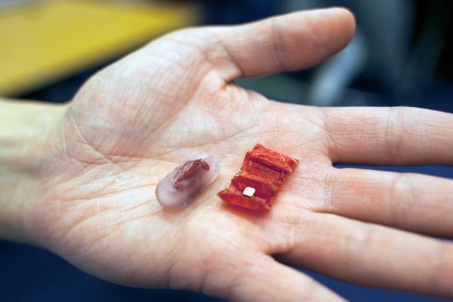 Nanorobotlar vasitəsilə insan həyatını xilas etmək mümkün olacaq
