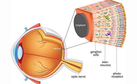 Engineers taught artificial retina to process only useful visual information
