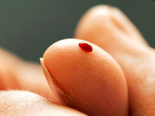 Yeni texnologiya xərçəng xəstəliyini 3 dəqiqə ərzində aşkar etməyə imkan verəcək, Elm və Təhsil Nazirliyi, Elm ve Tehsil Nazirliyi, Azərbaycan Respublikası Elm və Təhsil Nazirliyi, Azerbaycan Respublikasi Elm ve Tehsil Nazirliyi, Elm və Ali Təhsil üzrə Dövlət Agentliyi, Elm və Ali Təhsil, AMEA, Azərbaycan Milli Elmlər Akademiyası, Elmler Akademiyasi, İnformasiya Texnologiyaları İnstitutu, İnformasiya Texnologiyaları, AMEA ITI, AMEA İTİ, İTİ, ITI, ikt.az, ict.az, ict, ikt, www.ict.az, www.ikt.az, Rasim Aliguliyev, Rasim Əliquliyev, RM Əliquliyev, Əliquliyev Rasim, Academician Rasim Aliguliyev