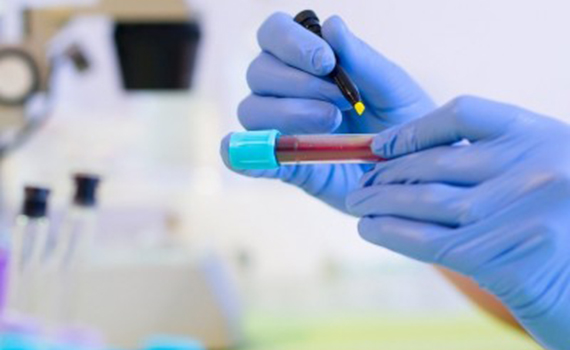 Süni intellekt analiz nəticələrinə əsasən diaqnoz qoyacaq, Elm və Təhsil Nazirliyi, Elm ve Tehsil Nazirliyi, Azərbaycan Respublikası Elm və Təhsil Nazirliyi, Azerbaycan Respublikasi Elm ve Tehsil Nazirliyi, Elm və Ali Təhsil üzrə Dövlət Agentliyi, Elm və Ali Təhsil, AMEA, Azərbaycan Milli Elmlər Akademiyası, Elmler Akademiyasi, İnformasiya Texnologiyaları İnstitutu, İnformasiya Texnologiyaları, AMEA ITI, AMEA İTİ, İTİ, ITI, ikt.az, ict.az, ict, ikt, www.ict.az, www.ikt.az, Rasim Aliguliyev, Rasim Əliquliyev, RM Əliquliyev, Əliquliyev Rasim, Academician Rasim Aliguliyev