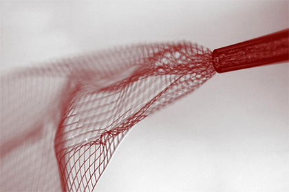 Neyrofizioloqlar beyinə şprislə elektronika yeridiblər, Elm və Təhsil Nazirliyi, Elm ve Tehsil Nazirliyi, Azərbaycan Respublikası Elm və Təhsil Nazirliyi, Azerbaycan Respublikasi Elm ve Tehsil Nazirliyi, Elm və Ali Təhsil üzrə Dövlət Agentliyi, Elm və Ali Təhsil, AMEA, Azərbaycan Milli Elmlər Akademiyası, Elmler Akademiyasi, İnformasiya Texnologiyaları İnstitutu, İnformasiya Texnologiyaları, AMEA ITI, AMEA İTİ, İTİ, ITI, ikt.az, ict.az, ict, ikt, www.ict.az, www.ikt.az, Rasim Aliguliyev, Rasim Əliquliyev, RM Əliquliyev, Əliquliyev Rasim, Academician Rasim Aliguliyev