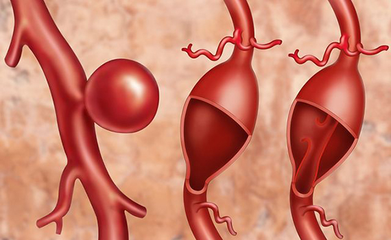 Robot sistemi ilk dəfə anevrizma xəstəliyini aradan qaldırıb, Elm və Təhsil Nazirliyi, Elm ve Tehsil Nazirliyi, Azərbaycan Respublikası Elm və Təhsil Nazirliyi, Azerbaycan Respublikasi Elm ve Tehsil Nazirliyi, Elm və Ali Təhsil üzrə Dövlət Agentliyi, Elm və Ali Təhsil, AMEA, Azərbaycan Milli Elmlər Akademiyası, Elmler Akademiyasi, İnformasiya Texnologiyaları İnstitutu, İnformasiya Texnologiyaları, AMEA ITI, AMEA İTİ, İTİ, ITI, ikt.az, ict.az, ict, ikt, www.ict.az, www.ikt.az, Rasim Aliguliyev, Rasim Əliquliyev, RM Əliquliyev, Əliquliyev Rasim, Academician Rasim Aliguliyev
