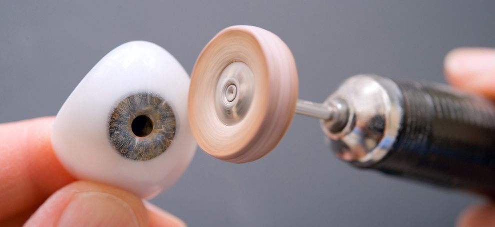 Korea announced the commercial 3D printing of eye prostheses
