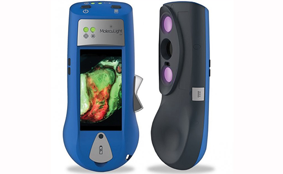 Yeni əl skaneri açıq yarada bakteriyaları görməyə imkan verir, Elm və Təhsil Nazirliyi, Elm ve Tehsil Nazirliyi, Azərbaycan Respublikası Elm və Təhsil Nazirliyi, Azerbaycan Respublikasi Elm ve Tehsil Nazirliyi, Elm və Ali Təhsil üzrə Dövlət Agentliyi, Elm və Ali Təhsil, AMEA, Azərbaycan Milli Elmlər Akademiyası, Elmler Akademiyasi, İnformasiya Texnologiyaları İnstitutu, İnformasiya Texnologiyaları, AMEA ITI, AMEA İTİ, İTİ, ITI, ikt.az, ict.az, ict, ikt, www.ict.az, www.ikt.az, Rasim Aliguliyev, Rasim Əliquliyev, RM Əliquliyev, Əliquliyev Rasim, Academician Rasim Aliguliyev