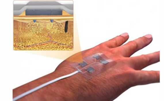 “Ağıllı” sarğı xroniki yaraları müalicə edəcək, Elm və Təhsil Nazirliyi, Elm ve Tehsil Nazirliyi, Azərbaycan Respublikası Elm və Təhsil Nazirliyi, Azerbaycan Respublikasi Elm ve Tehsil Nazirliyi, Elm və Ali Təhsil üzrə Dövlət Agentliyi, Elm və Ali Təhsil, AMEA, Azərbaycan Milli Elmlər Akademiyası, Elmler Akademiyasi, İnformasiya Texnologiyaları İnstitutu, İnformasiya Texnologiyaları, AMEA ITI, AMEA İTİ, İTİ, ITI, ikt.az, ict.az, ict, ikt, www.ict.az, www.ikt.az, Rasim Aliguliyev, Rasim Əliquliyev, RM Əliquliyev, Əliquliyev Rasim, Academician Rasim Aliguliyev