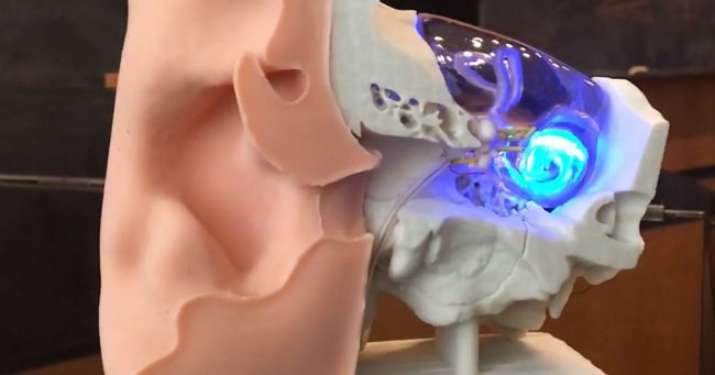 Eşitmə qabiliyyətini bərpa edən implantat yaradılıb, Elm və Təhsil Nazirliyi, Elm ve Tehsil Nazirliyi, Azərbaycan Respublikası Elm və Təhsil Nazirliyi, Azerbaycan Respublikasi Elm ve Tehsil Nazirliyi, Elm və Ali Təhsil üzrə Dövlət Agentliyi, Elm və Ali Təhsil, AMEA, Azərbaycan Milli Elmlər Akademiyası, Elmler Akademiyasi, İnformasiya Texnologiyaları İnstitutu, İnformasiya Texnologiyaları, AMEA ITI, AMEA İTİ, İTİ, ITI, ikt.az, ict.az, ict, ikt, www.ict.az, www.ikt.az, Rasim Aliguliyev, Rasim Əliquliyev, RM Əliquliyev, Əliquliyev Rasim, Academician Rasim Aliguliyev