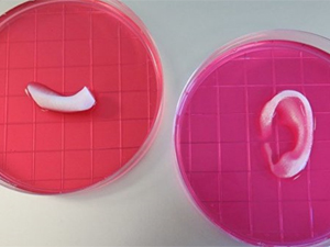 A 3D bioprinting system to produce human-scale tissue constructs