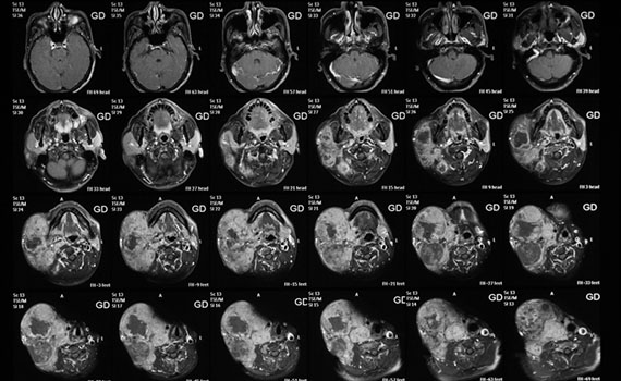 Süni intellekt insanın fiziki ağrı qorxusunu müəyyənləşdirir, Elm və Təhsil Nazirliyi, Elm ve Tehsil Nazirliyi, Azərbaycan Respublikası Elm və Təhsil Nazirliyi, Azerbaycan Respublikasi Elm ve Tehsil Nazirliyi, Elm və Ali Təhsil üzrə Dövlət Agentliyi, Elm və Ali Təhsil, AMEA, Azərbaycan Milli Elmlər Akademiyası, Elmler Akademiyasi, İnformasiya Texnologiyaları İnstitutu, İnformasiya Texnologiyaları, AMEA ITI, AMEA İTİ, İTİ, ITI, ikt.az, ict.az, ict, ikt, www.ict.az, www.ikt.az, Rasim Aliguliyev, Rasim Əliquliyev, RM Əliquliyev, Əliquliyev Rasim, Academician Rasim Aliguliyev