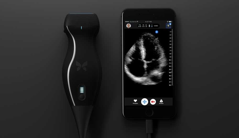 Pocket ultrasound machine, working in tandem with a smartphone was created