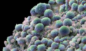 Xəstəliklərin diaqnostikası üçün süni intellekt alqoritmləri tətbiq olunacaq, Elm və Təhsil Nazirliyi, Elm ve Tehsil Nazirliyi, Azərbaycan Respublikası Elm və Təhsil Nazirliyi, Azerbaycan Respublikasi Elm ve Tehsil Nazirliyi, Elm və Ali Təhsil üzrə Dövlət Agentliyi, Elm və Ali Təhsil, AMEA, Azərbaycan Milli Elmlər Akademiyası, Elmler Akademiyasi, İnformasiya Texnologiyaları İnstitutu, İnformasiya Texnologiyaları, AMEA ITI, AMEA İTİ, İTİ, ITI, ikt.az, ict.az, ict, ikt, www.ict.az, www.ikt.az, Rasim Aliguliyev, Rasim Əliquliyev, RM Əliquliyev, Əliquliyev Rasim, Academician Rasim Aliguliyev