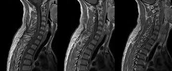 “Ağıllı onurğa” insanları iflicdən xilas edəcək, Elm və Təhsil Nazirliyi, Elm ve Tehsil Nazirliyi, Azərbaycan Respublikası Elm və Təhsil Nazirliyi, Azerbaycan Respublikasi Elm ve Tehsil Nazirliyi, Elm və Ali Təhsil üzrə Dövlət Agentliyi, Elm və Ali Təhsil, AMEA, Azərbaycan Milli Elmlər Akademiyası, Elmler Akademiyasi, İnformasiya Texnologiyaları İnstitutu, İnformasiya Texnologiyaları, AMEA ITI, AMEA İTİ, İTİ, ITI, ikt.az, ict.az, ict, ikt, www.ict.az, www.ikt.az, Rasim Aliguliyev, Rasim Əliquliyev, RM Əliquliyev, Əliquliyev Rasim, Academician Rasim Aliguliyev