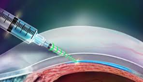 A smart needle was created for accurate injections