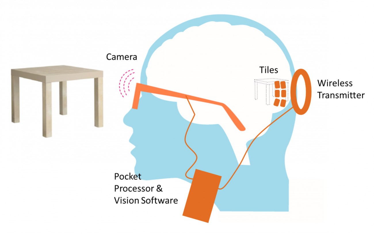 Görməyə imkan verən süni göz implantasiya edilib, Elm və Təhsil Nazirliyi, Elm ve Tehsil Nazirliyi, Azərbaycan Respublikası Elm və Təhsil Nazirliyi, Azerbaycan Respublikasi Elm ve Tehsil Nazirliyi, Elm və Ali Təhsil üzrə Dövlət Agentliyi, Elm və Ali Təhsil, AMEA, Azərbaycan Milli Elmlər Akademiyası, Elmler Akademiyasi, İnformasiya Texnologiyaları İnstitutu, İnformasiya Texnologiyaları, AMEA ITI, AMEA İTİ, İTİ, ITI, ikt.az, ict.az, ict, ikt, www.ict.az, www.ikt.az, Rasim Aliguliyev, Rasim Əliquliyev, RM Əliquliyev, Əliquliyev Rasim, Academician Rasim Aliguliyev